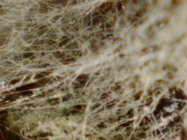 fungal hyphae